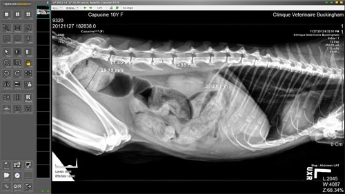 Radiographie numérique